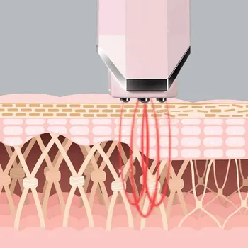 INFACE MS6000 (3 / 4)