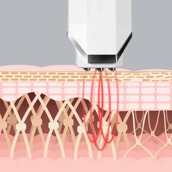 INFACE MS6000 WHITE (2 / 3)